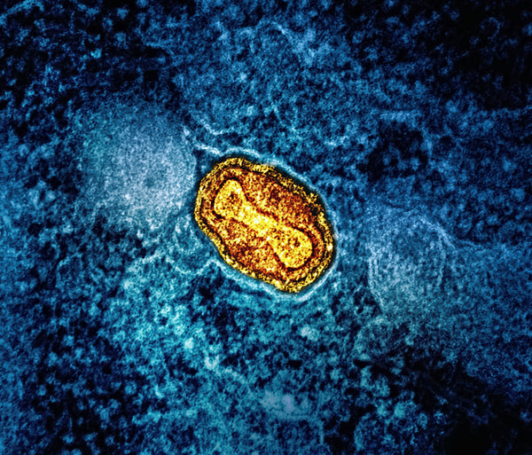 Dysfonction mitochondriale : quand l’énergie cellulaire ralentit